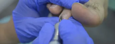 La imagen 3 de la Empresa DR. FISIO Salud y Medicina en Madrid M