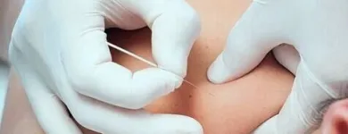 La imagen 16 de la Empresa FISIOTERAPIA BM Salud y Medicina en Valdemoro M