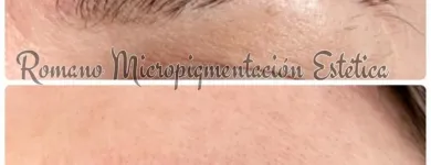 La imagen 1 de la Empresa ROMANO MICROPIGMENTACIÓN ESTÉTICA ONCOLÓGICA PARAMÉDICA Y MICROBLADING Salud y Medicina en Madrid M