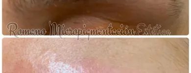La imagen 7 de la Empresa ROMANO MICROPIGMENTACIÓN ESTÉTICA ONCOLÓGICA PARAMÉDICA Y MICROBLADING Salud y Medicina en Madrid M