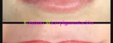 La imagen 10 de la Empresa ROMANO MICROPIGMENTACIÓN ESTÉTICA ONCOLÓGICA PARAMÉDICA Y MICROBLADING Salud y Medicina en Madrid M