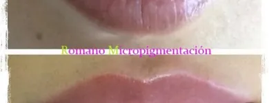 La imagen 16 de la Empresa ROMANO MICROPIGMENTACIÓN ESTÉTICA ONCOLÓGICA PARAMÉDICA Y MICROBLADING Salud y Medicina en Madrid M
