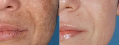 La imagen 1 de la Empresa SALÓN LOUNGE ESTILISTES Salud y Medicina en Barcelona B