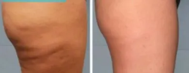 La imagen 10 de la Empresa SALÓN LOUNGE ESTILISTES Salud y Medicina en Barcelona B