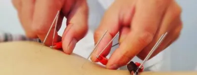 La imagen 9 de la Empresa YINYANG NATURE - ACUPUNTURA E HIGIENISMO Terapias Alternativas y Complementarias en Madrid M