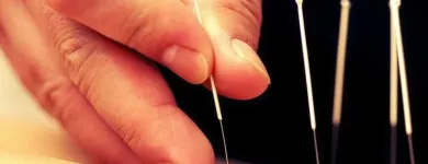 La imagen 10 de la Empresa YINYANG NATURE - ACUPUNTURA E HIGIENISMO Terapias Alternativas y Complementarias en Madrid M