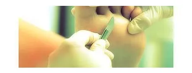 La imagen 4 de la Empresa YLENIA PÉREZ PODOLOGÍA Salud y Medicina en Santa María del Águila AL