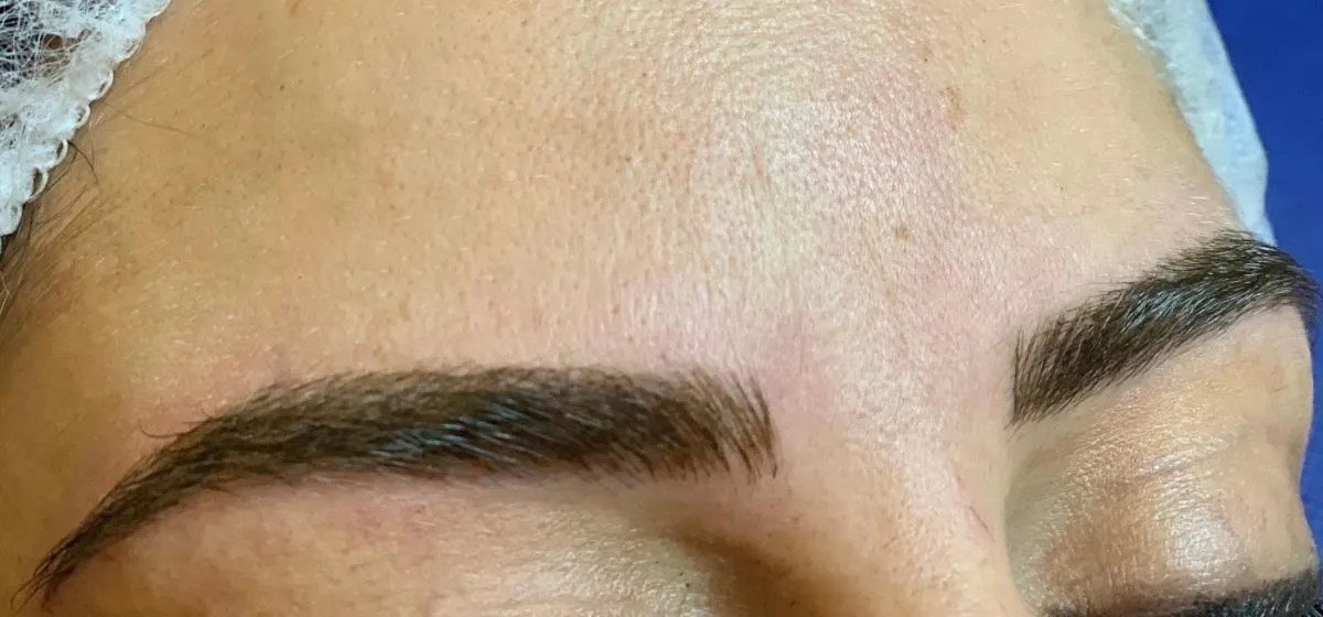 La imagen 3 de la Empresa ROMANO MICROPIGMENTACIÓN ESTÉTICA ONCOLÓGICA PARAMÉDICA Y MICROBLADING