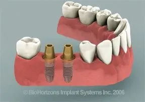 La imagen 1 de la Empresa FIRST DENTAL