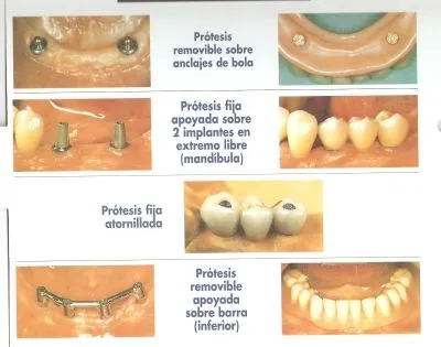 La imagen 1 de la Empresa CLINICA DENTAL CLI-DEN