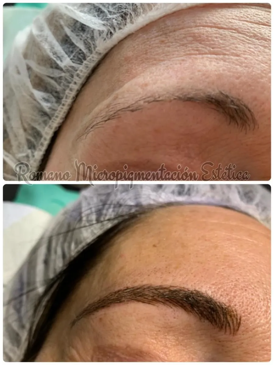 La imagen 8 de la Empresa ROMANO MICROPIGMENTACIÓN ESTÉTICA ONCOLÓGICA PARAMÉDICA Y MICROBLADING