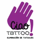 CIAO TATTOO Eliminacion De Tatuaje en Sevilla SE